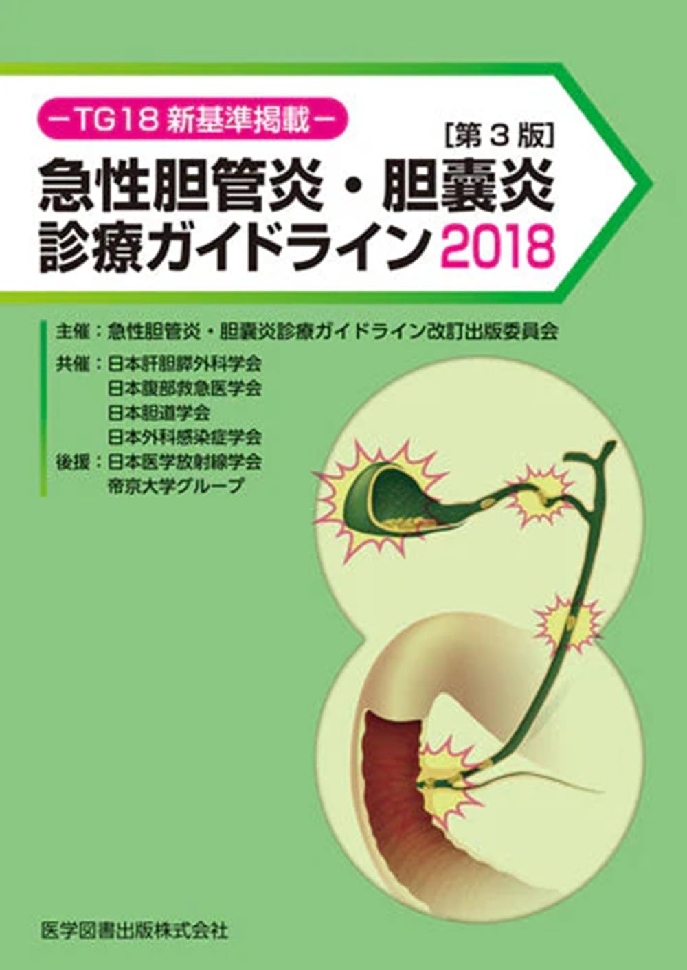 急性胆管炎・胆嚢炎診療ガイドライン2018 | 高田 忠敬 |本 | 通販 | Amazon